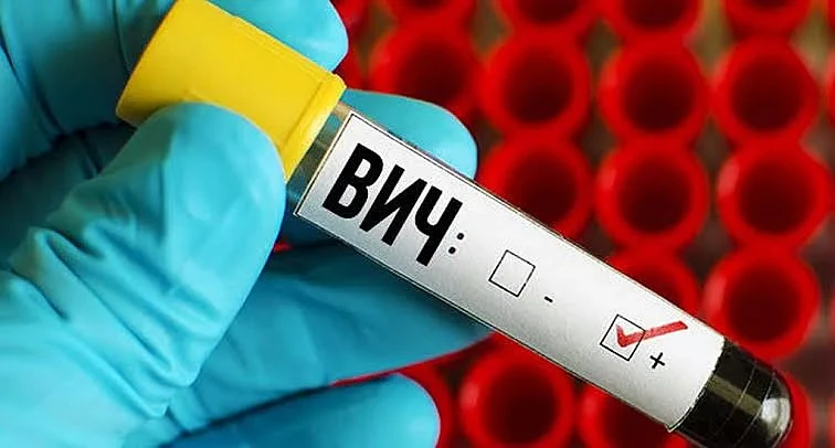 Ukrayna Mikolayiv bölgesinde 19 yeni HIV vakası, 2 ölüm bildirildi