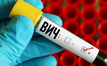 Ukrayna Mikolayiv bölgesinde 19 yeni HIV vakası, 2 ölüm bildirildi