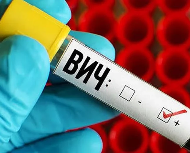 Ukrayna Mikolayiv bölgesinde 19 yeni HIV vakası, 2 ölüm bildirildi