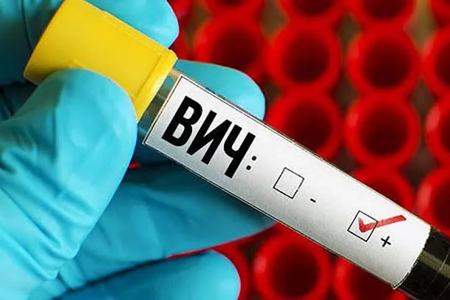 Ukrayna Mikolayiv bölgesinde 19 yeni HIV vakası, 2 ölüm bildirildi